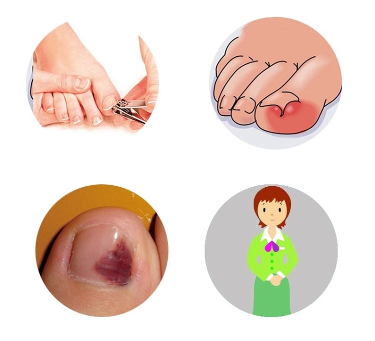 thumb