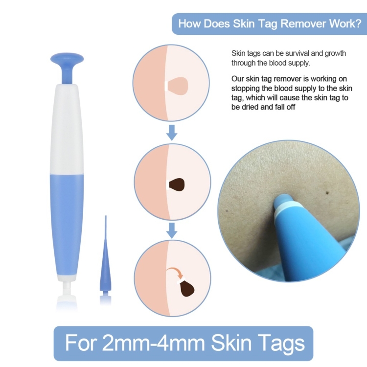 Skin Tag Removal Tool For 2mm-4mm Skin Tags Without Acne Patch - B1