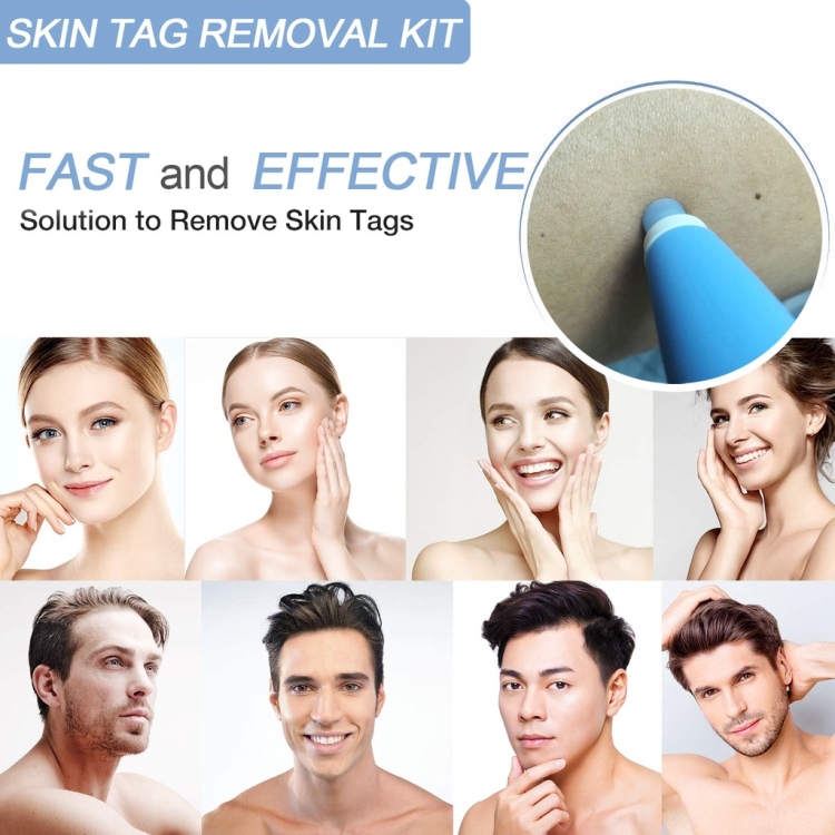 Skin Tag Removal Tool For 2mm-4mm Skin Tags With  Acne Patch - B5