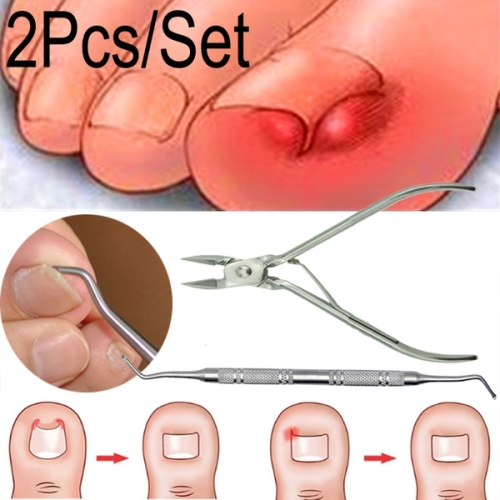 

Ingrown Foot Care Tool Toe Nail Correction Nippers Clipper Cutters Dead Skin Dirt Remover(2PCS/set)