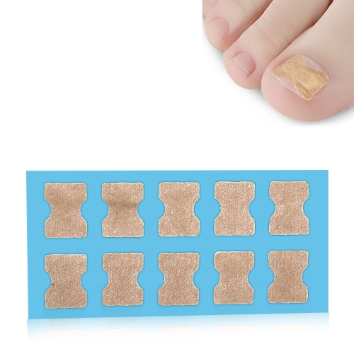 

10 PCS Glue-free Orthopedic Nail Stick Toe Nail Groove Inlay Corrector(Blue Bottom )