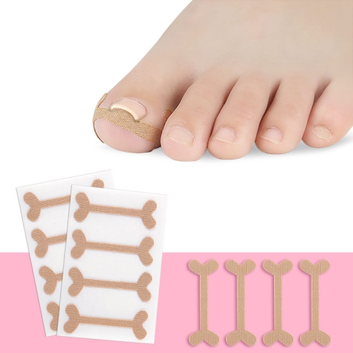 

10 Sets Rolled Nail Correction Tape Toe Nail Groove Tape(One size-4 stickers / sheet)